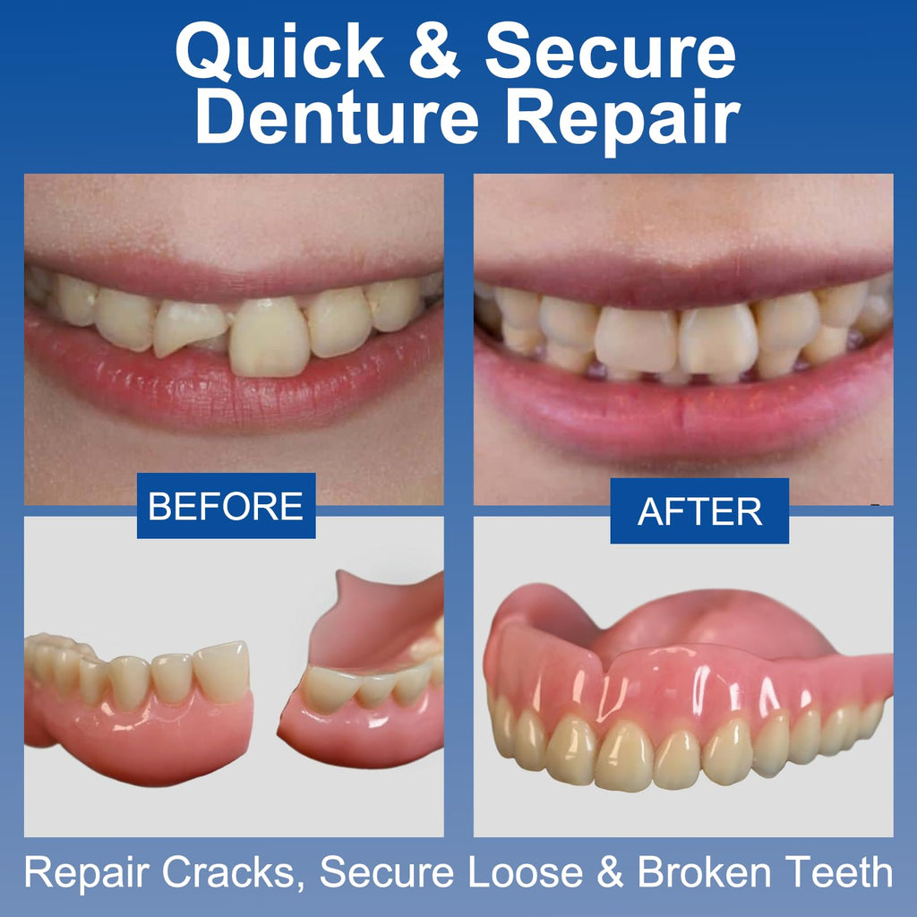 1 oz Clear Dental Bonding Glue N537619